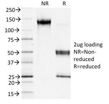 FSP1 Antibody / S100A4