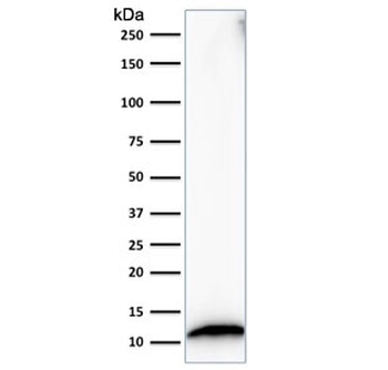S100A4 Antibody / FSP1