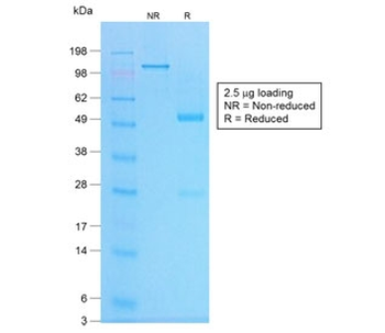 Recombinant Chromogranin A Antibody / Rabbit Monoclonal