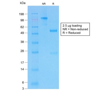 Recombinant CFTR Antibody / Rabbit Monoclonal
