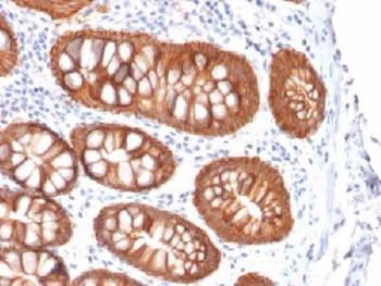 Recombinant Ep-CAM Antibody / Mouse Monoclonal