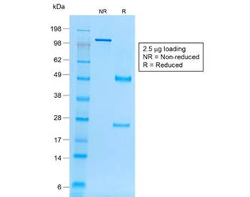 Recombinant Ep-CAM Antibody / Mouse Monoclonal