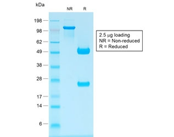 Recombinant IgG Antibody / Rabbit Monoclonal