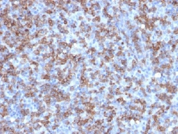 Recombinant CD8 Antibody (alpha chain) / Rabbit Monoclonal