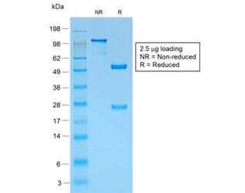 Recombinant gp100 Antibody / PMEL17 / Rabbit Monoclonal