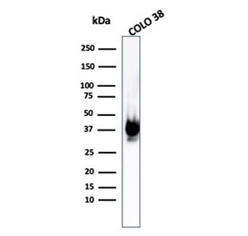 Recombinant gp100 Antibody / PMEL17 / Rabbit Monoclonal