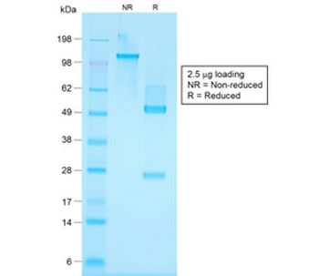 Recombinant Basic Cytokeratin Antibody / Rabbit Monoclonal