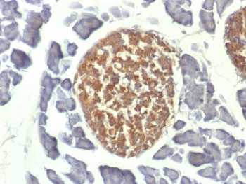 Neuron Specific Enolase Antibody / NSE