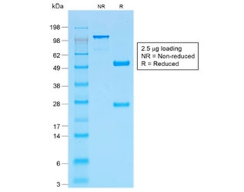 Recombinant p53 Antibody / Rabbit Monoclonal