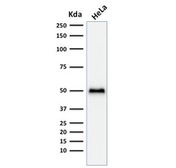 Recombinant p53 Antibody / Rabbit Monoclonal