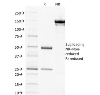 TYMS Antibody / Thymidylate Synthase