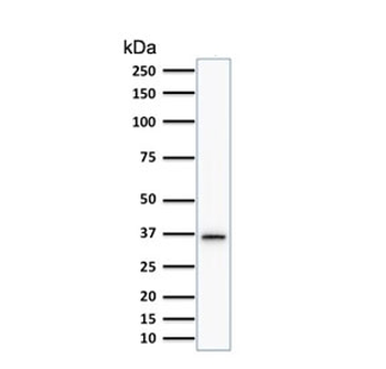 TYMS Antibody / Thymidylate Synthase