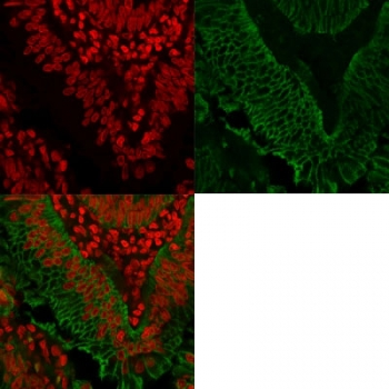 EpCAM Antibody / Extracellular domain