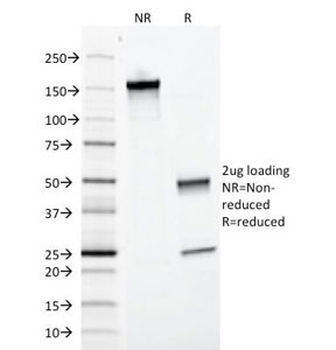 EpCAM Antibody / Extracellular domain