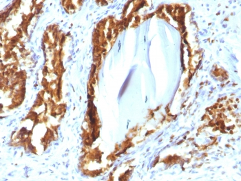 Recombinant PSAP Antibody