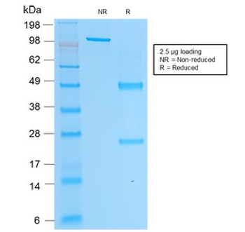 Recombinant PSAP Antibody