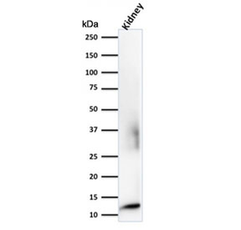 Recombinant Beta-2 Microglobulin Antibody