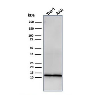 Recombinant Beta-2 Microglobulin Antibody
