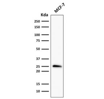 Recombinant Bcl-2 Antibody
