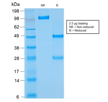 Recombinant Bcl2 Antibody