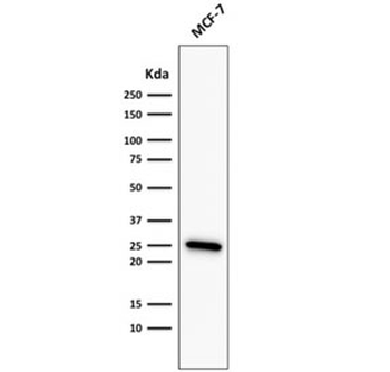 Recombinant Bcl2 Antibody
