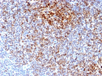 Recombinant Bcl-2 Antibody / Rabbit Monoclonal