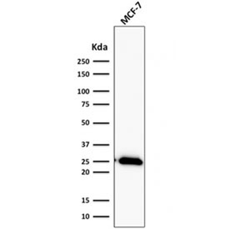 Recombinant Bcl-2 Antibody / Rabbit Monoclonal