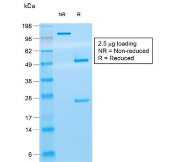 Recombinant CD8A Antibody