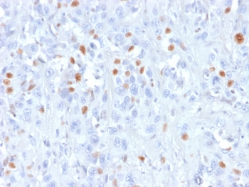 Recombinant p21 Antibody