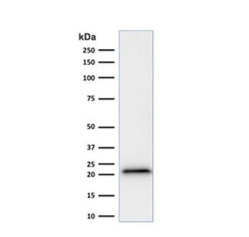 Recombinant p21 Antibody
