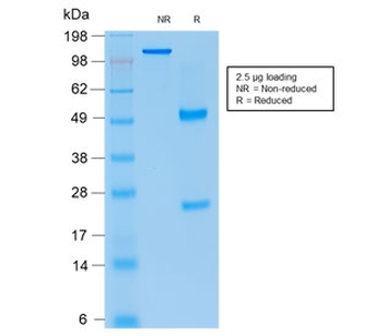 Recombinant p21 Antibody