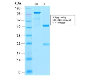 Recombinant CDNK1A Antibody / p21