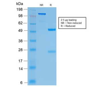 Recombinant CFTR Antibody / Rabbit Monoclonal