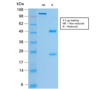 Recombinant CFTR Antibody