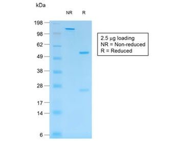 Recombinant S100B Antibody