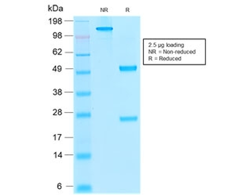 Recombinant Thrombomodulin Antibody / CD141