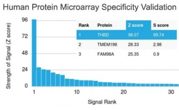 Recombinant Thrombomodulin Antibody / CD141