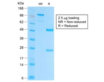 Recombinant EpCAM Antibody / Extracellular domain