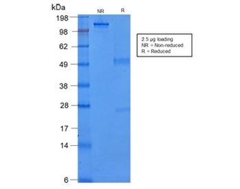 Recombinant CK8 Antibody / Cytokeratin 8