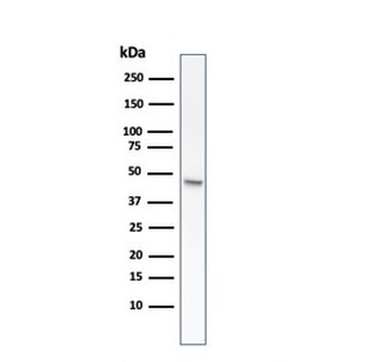Recombinant CK8 Antibody / Cytokeratin 8