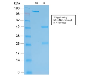 Recombinant HCG-beta Antibody