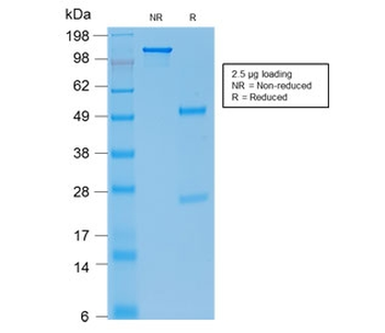 Recombinant E-Cadherin Antibody