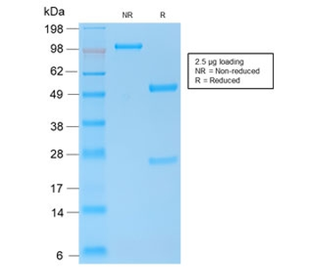 Recombinant E-Cadherin Antibody / Rabbit Monoclonal