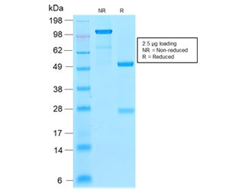 Recombinant Ferritin Light Chain Antibody / Rabbit Monoclonal
