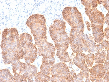 Recombinant EpCAM Antibody / Extracellular domain