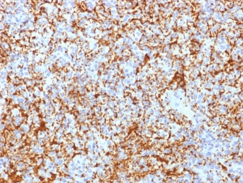 Recombinant Integrin beta 3 Antibody / ITGB3 / CD61