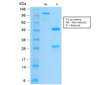Recombinant Integrin beta 3 Antibody / ITGB3 / CD61