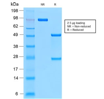 Recombinant CD44v9 Antibody / Rabbit Monoclonal