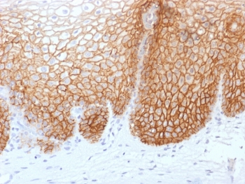 Recombinant CD44v9 Antibody