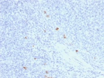 Recombinant IgG4 Antibody